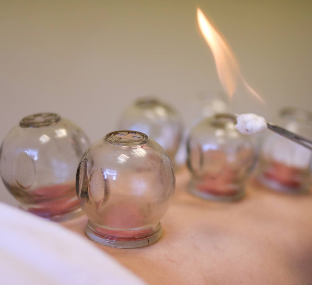 Acupuncture Natural Health Care Center